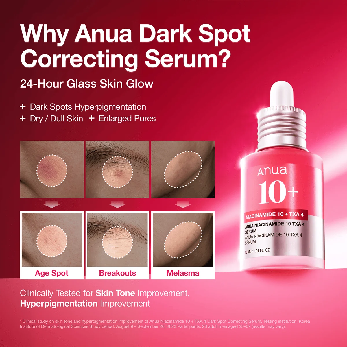 Anua Niacinamide 10% + TXA 4% Dark Spot Correcting Serum 30ml